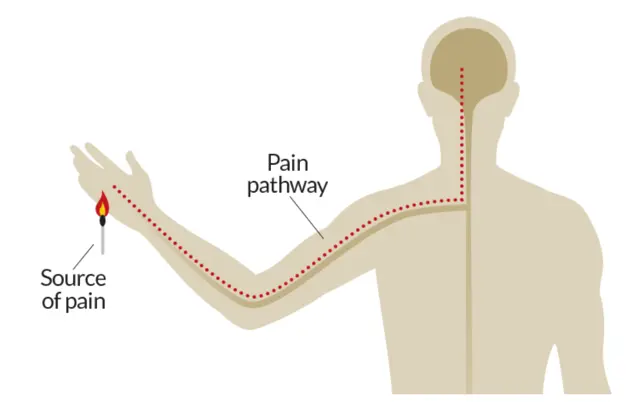 Pelvic pain travels from the source of pain thru the pain pathway